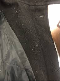 wool coat is pilling